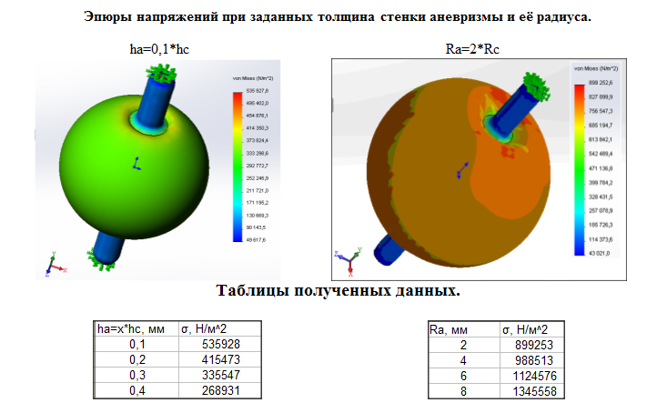 3D модель Аневризма